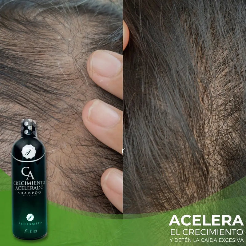 Shampoo Crecimiento Acelerado + 02 Obsequios Totalmente Gratis