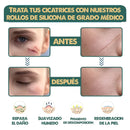 cinta anti arrugas y cicatrices