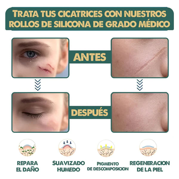 cinta anti arrugas y cicatrices